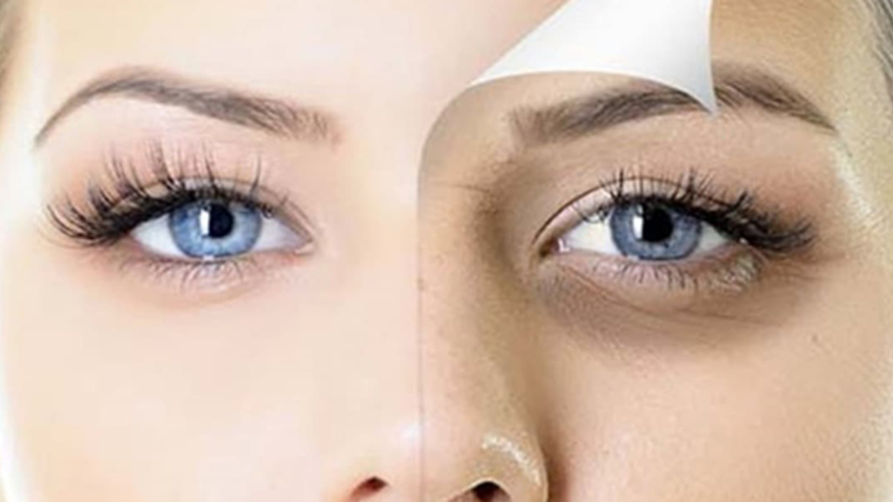 Göz altı morlukları nasıl geçer ve ne iyi gelir?