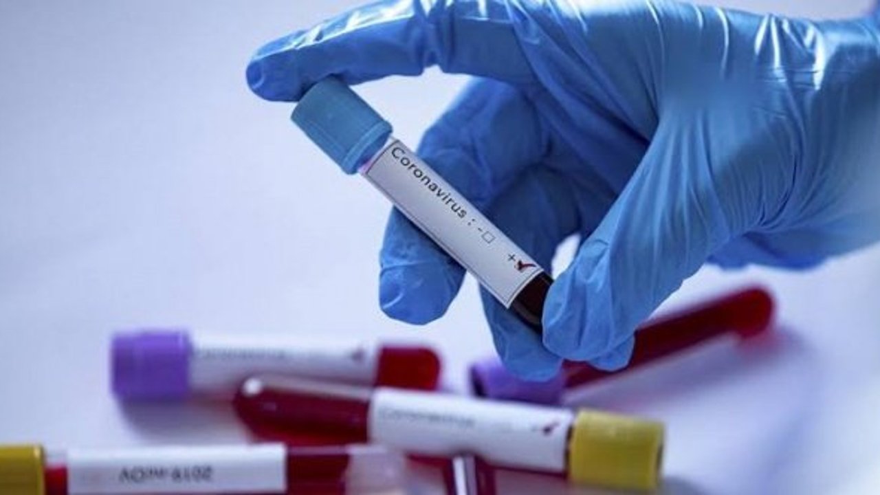 En Yavaş Yaşlanan Kan Grubu Belli Oldu!