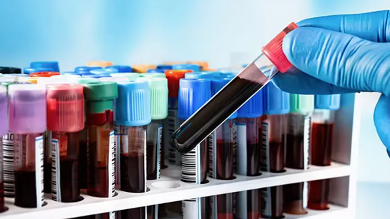 Bilim Kurgu gerçek oldu: Basit bir kan testiyle ömrünüz tahmin edilebilecek