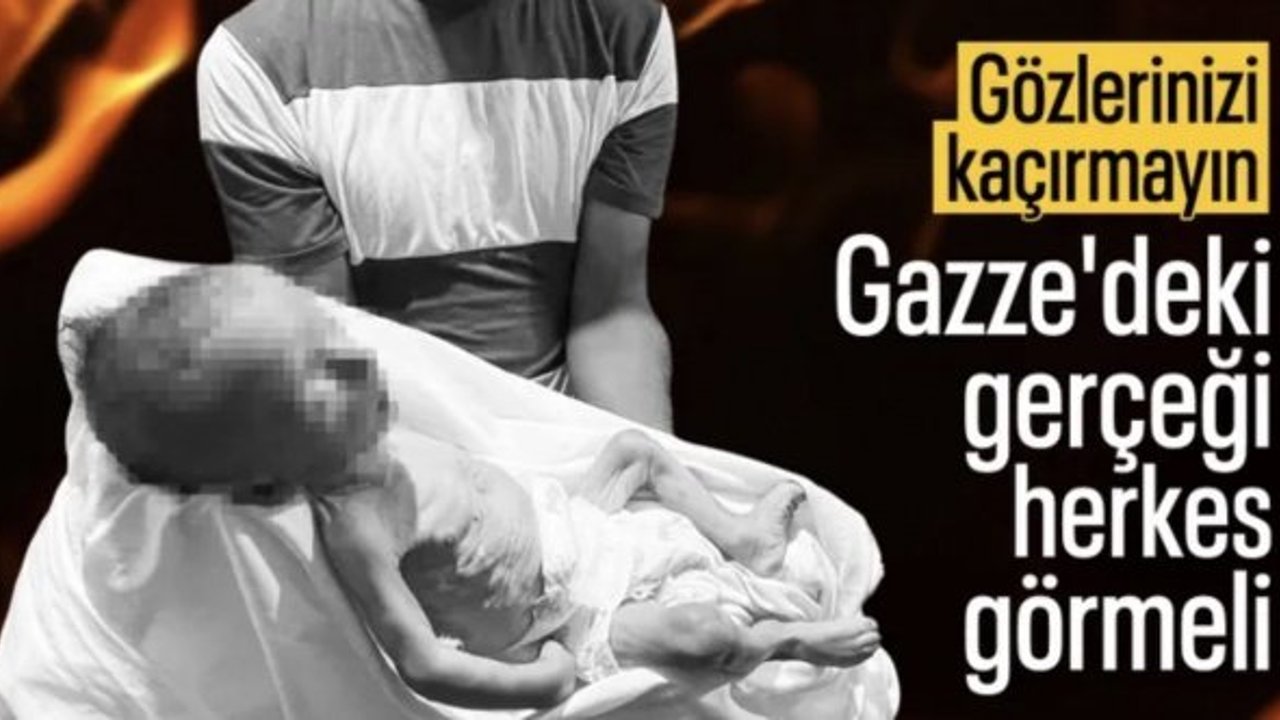 Gazze'de bir bebek daha açlıktan öldü