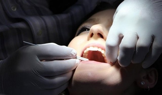 Diş dolgusu yaptıranlar dikkat! Dolgulu dişler tekrar çürüyebilir