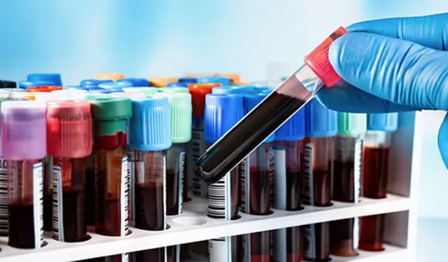 Bilim Kurgu gerçek oldu: Basit bir kan testiyle ömrünüz tahmin edilebilecek