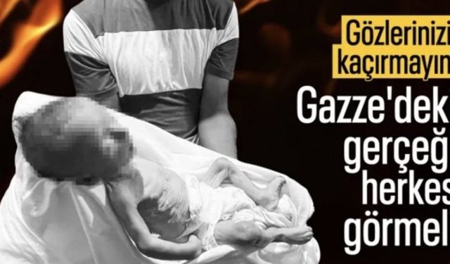 Gazze'de bir bebek daha açlıktan öldü