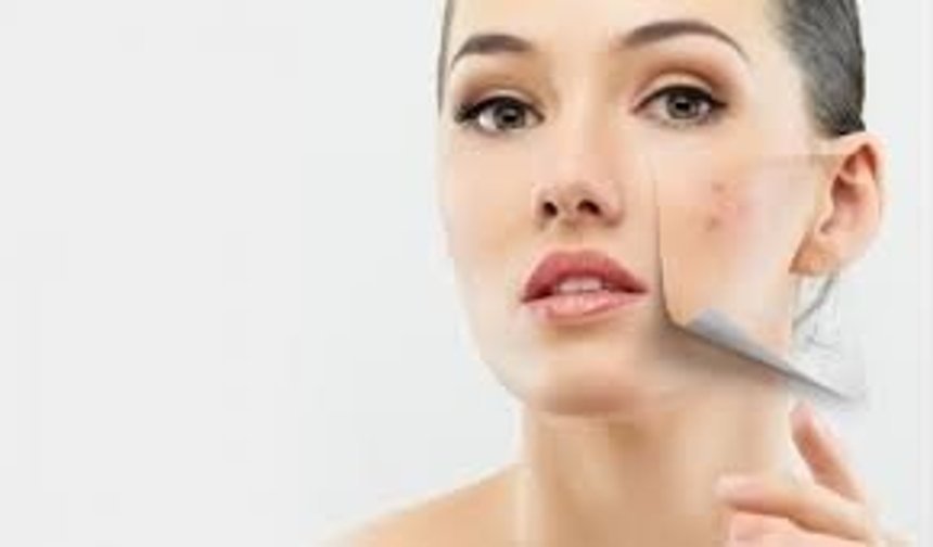 Cilt Lekeleri İçin Güzellik Sırları